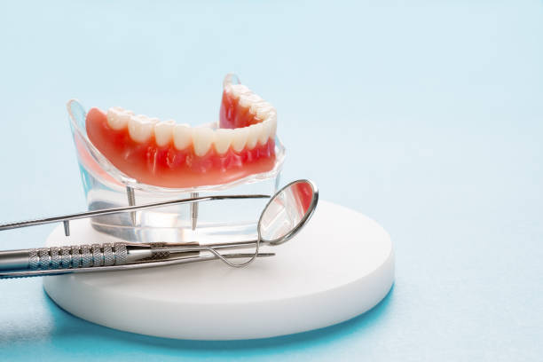Full Mouth Reconstruction in Mitchell, SD